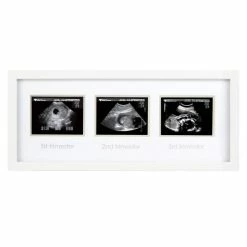 Best reviews of β¨ Pearhead Bilderrahmen fΓΌr Ultraschallbilder Trimester π€©