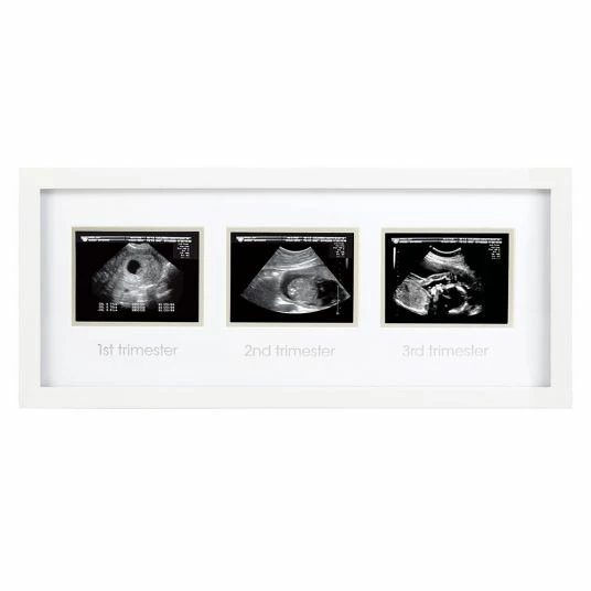 Best reviews of ✨ Pearhead Bilderrahmen für Ultraschallbilder Trimester 🤩 1 Best reviews of ✨ Pearhead Bilderrahmen für Ultraschallbilder Trimester 🤩