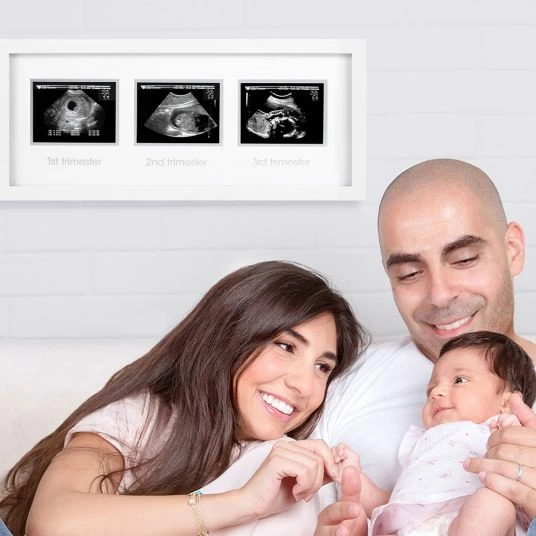 Best reviews of ✨ Pearhead Bilderrahmen für Ultraschallbilder Trimester 🤩 2 Best reviews of ✨ Pearhead Bilderrahmen für Ultraschallbilder Trimester 🤩 - Image 2